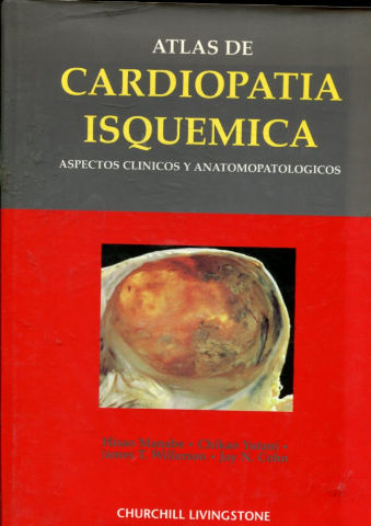 ATLAS DE CARDIOPATIA ISQUEMICA. ASPECTOS CLINICOS Y ANATOMOPATOLOGICOS.