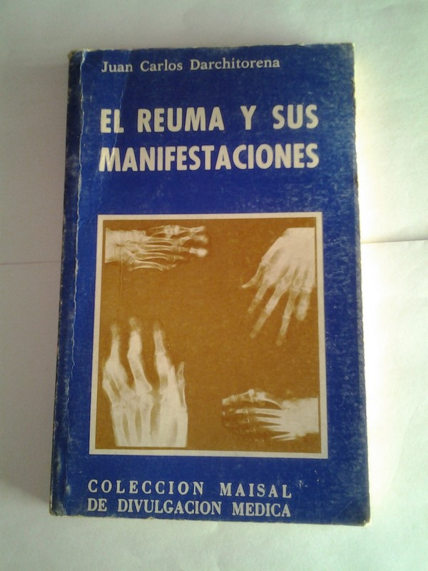 El reuma y sus manifestaciones