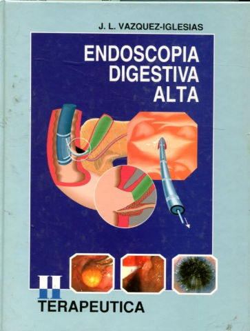 ENDOSCOPIA DIGESTIVA ALTA. TOMO I. DIAGNOSTICO.