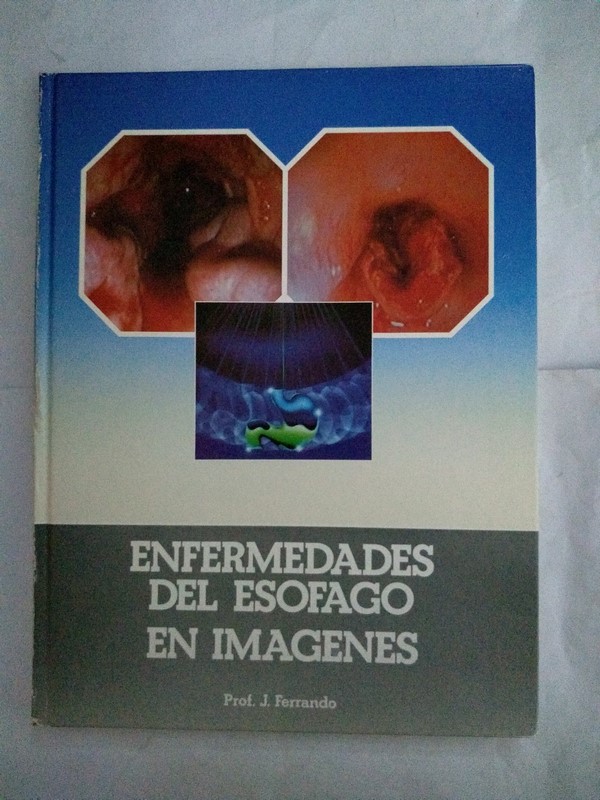 Enfermedades del esofago en imagen