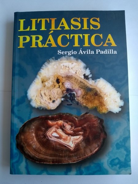 Litiasis Practica