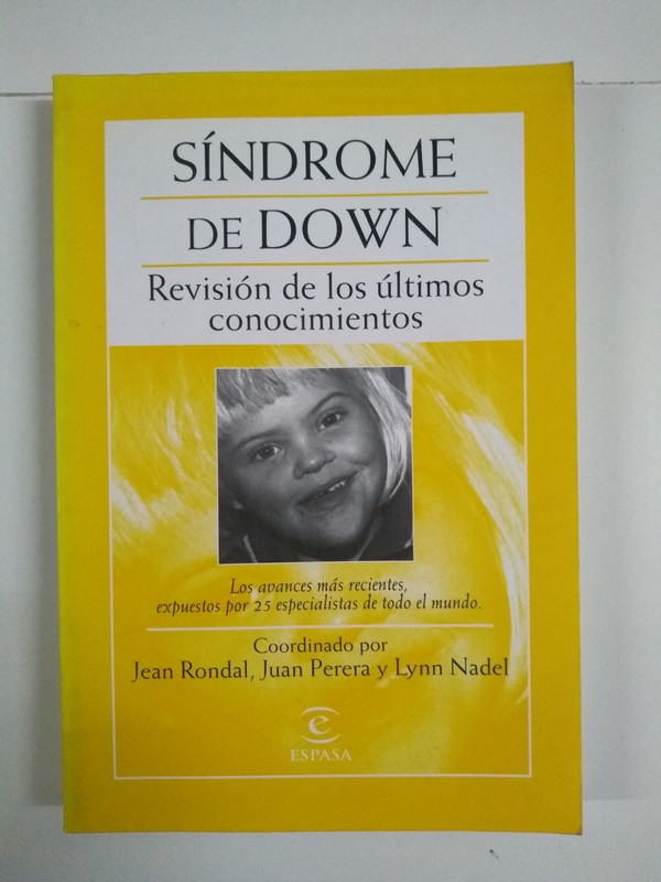 Síndrome de down: revisión de los últimos conocimientos